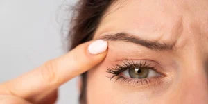 сухість повік