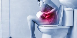 як позбутися запору