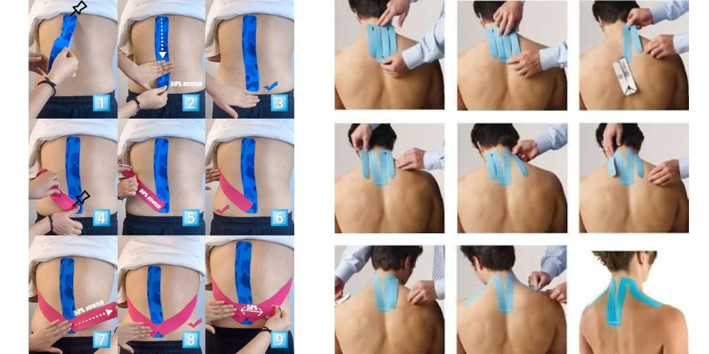 кінезіотейпування спини