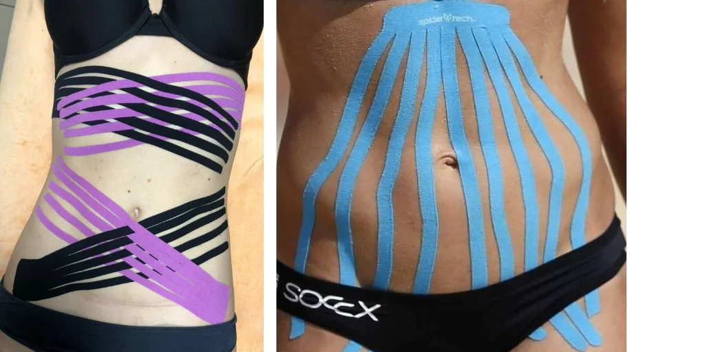 тейпування живота